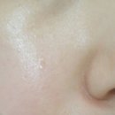 엔젤피부케어