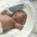 울산대학교 | 신생아 귀 접힘 교정후기 - 울산대학교병원 강병철 교수 ‘해피 뉴 이어’