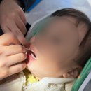 킴스치과의원 | 원주 킴스주니어치과 27개월 첫 구강검진, 불소도포 후기