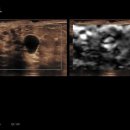 (주)인메디칼 이미지