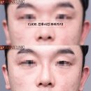 하이코코 이미지