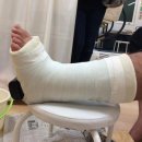 운동하고 나서 "이 부위 통증" 방치하면 힘줄 파열까지 생깁니다. 이미지