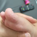 침산미소약국 네이버블로그
