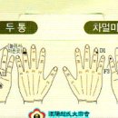 수지침 이미지