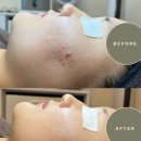 필바이오 이미지