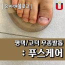 푸스케어 가격 내돈내산 무좀발톱 관리후기