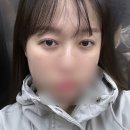 쫄보의 눈밑지 후기 : 일주일~현재 두 달 차 모습까지 (부작용, 추천여부 등)