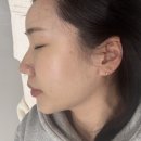 송파피부관리 보라다움 - 수분관리 톤업 후기