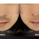 동탄스노우의원 이미지