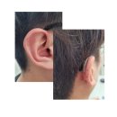 (주)아게이트 복음보청기 영등포점 | 영등포보청기/당산보청기] 오티콘 리얼1(Real 1) 착용후기