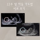 12주각도법 딸아들비교,후기/먹는음식/태몽/입덧차이