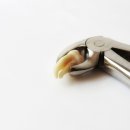 닥터오치과의원 | 사랑니 발치 후 통증 주의사항 음식 발치 비용 전 주의사항