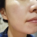 허브에스 | 피부과모델링팩 닥터에스지앤 허브 모델링팩 카모마일