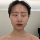 진짜 찐으로 대만족이였던 천안윤곽관리 온비스떼 대강추