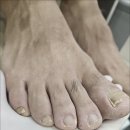 까망속눈썹&네일 | 서대전네거리 발톱무좀 파고드는발톱까지 깔끔하게 닥터아이티엔 네일 까망아트