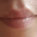 온메디케어 이미지