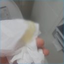 이화산부인과의원 네이버블로그