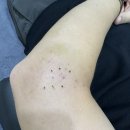 구산인성한의원 | 테니스와 골프로 생긴 팔꿈치 엘보 2년간 정형외과 치료를 접고 한의원 치료 생생후기 (1)