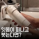 잇몸 피나고 붓는다면? 치과 대신 매일 집에서 관리하는 오아 클린이포터블 사용법