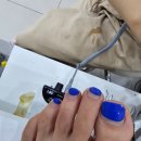 오누네일