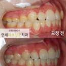 연세미소담은치과 이미지