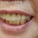 연세에스치과의원 | 신당동치과 연세에스치과의원 안심이 곧 편안함이 되는 곳!