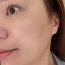 연산LG제2경로당 | |부산 연산동 최정윤피부연구소| 예민홍조피지트러블 케어 잘하는 연산동피부관리 (세멘시트 관리 후기)