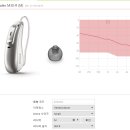 예산역보청기 | 대전보청기 부여 댁방문 착용 후기