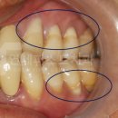 부마치과 이미지
