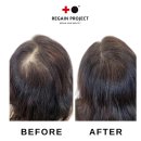 리게인프로젝트 일산 이미지