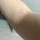 상동물병원 | 상동바른마취통증의학과의원 허리 및 팔꿈치 염증주사 및 물리치료 후기
