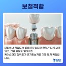 월드베스트디지털치과기공소 | 기공소선택기준! 보철평가표로 평가하는 기공소