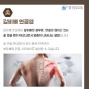 굿정형외과의원 네이버블로그