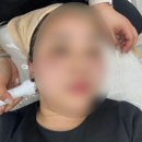 NC광주점미샤화장품 | 광주 북구 기미 주근깨 피부관리 잘하는 곳 추천 (일주일 후기) 1탄 _ 아임뷰티