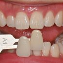 ONE DENTAL 이미지