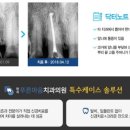서울자연이치과