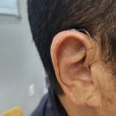 삼성히어링에이드 | 세종시보청기 귓속형 고민하시다 오픈형 선택 이유