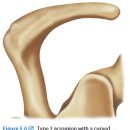 impingement syndrome : 문헌고찰 이미지