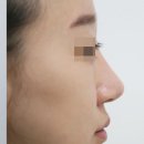 양동준성형외과 네이버블로그