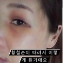 황철순 아내 폭행영상.gif 이미지