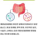 여자왼쪽 옆구리 통증 왼쪽 갈비뼈 아래 통증 원인 이미지