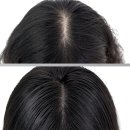 일상 | 인천 탈모성지 달라진 일상 후기