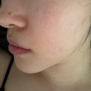 (주)스킨네이처 | 리쥬란 대체 가능한 피부관리 추천템 먹는 PDRN 리즈네이처 찐후기