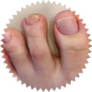 뷰티피아메디컬 | 루원시티페디케어 파고드는발톱 무좀앰플 후기 <뷰티피아>