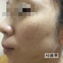 메디어스 | [체험후기] 메디어스 SOS 워터 밤 마스크 사용후기