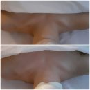 슬리밍웰빙방 | 신논현 마사지 바디투밸런스