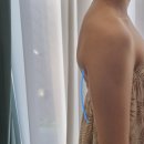 타임메디 | 광주 장덕동 365메디스킨 광주본점, 수완지구에스테틱 상체라인관리 후기