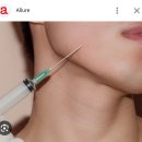 더마톡신 스킨보톡스 더모톡신 부작용 치료 후기 좋은 시술 훨씬 빨리 좋아져요(눈가 이마 입가 광대)