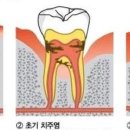 김강민치과의원 네이버블로그