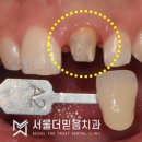 서울더믿음치과 이미지